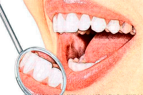 齊齊哈爾市中醫(yī)院正畸怎么樣_誰(shuí)做得好