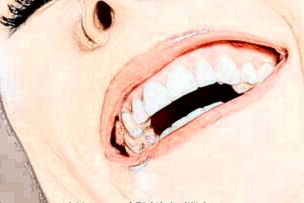 長沙科爾雅口腔醫(yī)院正畸做的好嗎?哪位醫(yī)生做得好