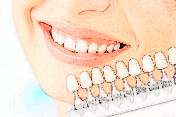 2024長(zhǎng)沙好大夫口腔醫(yī)院地包天矯正怎么樣_價(jià)格表_案例_地址