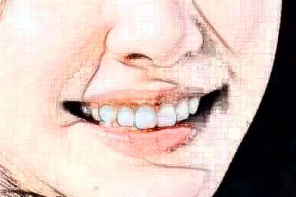 2024長(zhǎng)沙好大夫口腔醫(yī)院地包天矯正怎么樣_價(jià)格表_案例_地址2024長(zhǎng)沙好大夫口腔醫(yī)院地包天矯正怎么樣_價(jià)格表_案例_地址