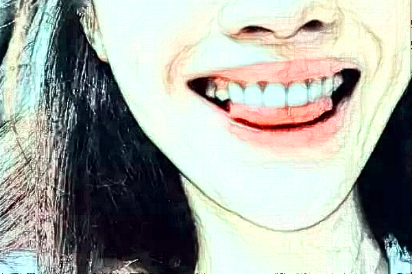 成都新橋口腔醫(yī)院根管疼嗎?根管的注意事項(xiàng)