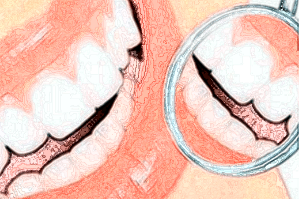 2024河北大學附屬醫(yī)院牙列不齊矯正怎么樣_整形日記分享