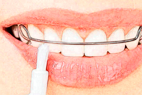 2024遼寧省人民醫(yī)院冷光美白好的大夫有誰?醫(yī)生簡介