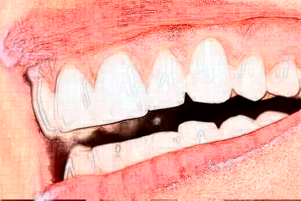 安徽醫(yī)科大學第一附屬醫(yī)院正畸做的好嗎?哪位醫(yī)生做得好