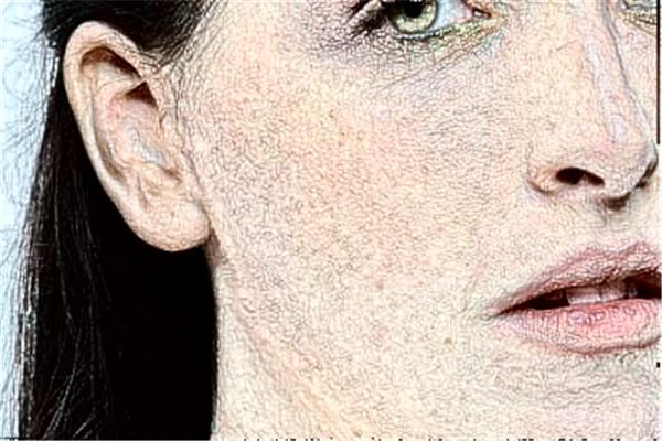 2024安徽省立醫(yī)院光子嫩膚怎么樣_應(yīng)該找誰做