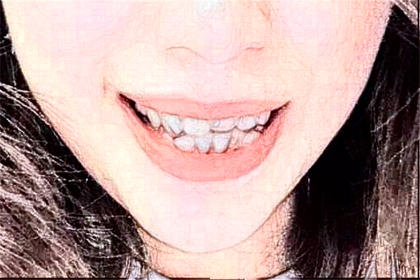 2024鎮(zhèn)江江濱醫(yī)院種牙貴嗎?那個醫(yī)生技術(shù)比較好