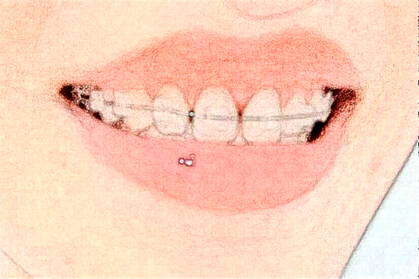 杭州植得口腔門診部專家介紹_好不好_怎么樣