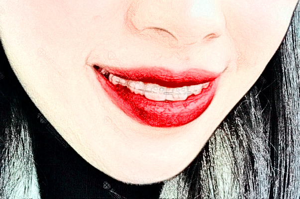 2024成都新橋口腔醫(yī)院烤瓷牙價格?烤瓷牙和全瓷牙的區(qū)別