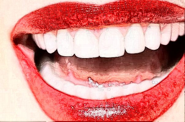 2024無(wú)錫市人民醫(yī)院補(bǔ)牙怎么樣【補(bǔ)牙案例】