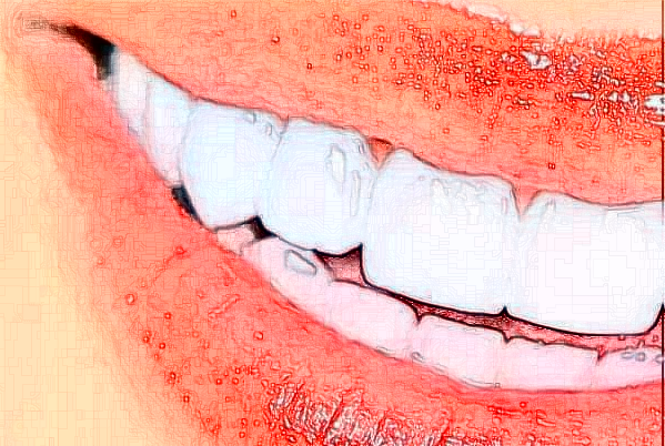 遼寧省人民醫(yī)院?jiǎn)窝婪N植好么?醫(yī)生推薦+整形案例參考~