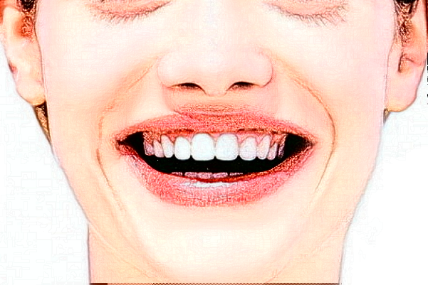 河北大學(xué)附屬醫(yī)院隱形矯正做的好嗎?哪位醫(yī)生做得好