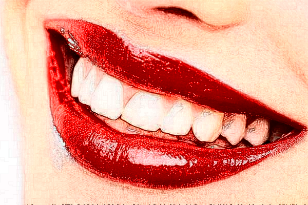 2024天津南開(kāi)醫(yī)院牙齒美白怎么樣_整形日記分享