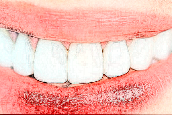 遼寧省人民醫(yī)院全瓷牙怎么樣|醫(yī)生介紹|價格收費