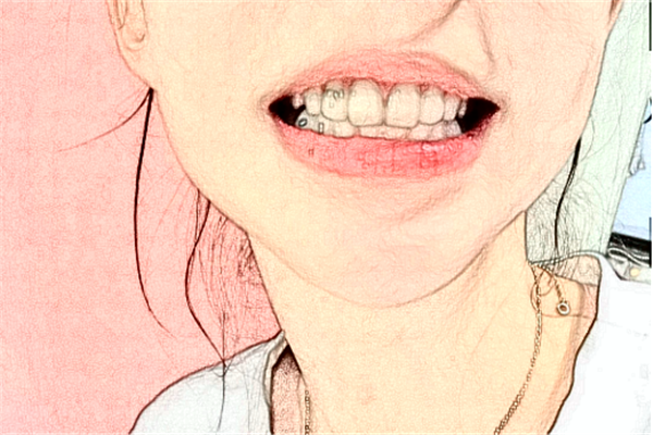 襄陽新德恩口腔門診部種植牙怎么樣_誰做得好