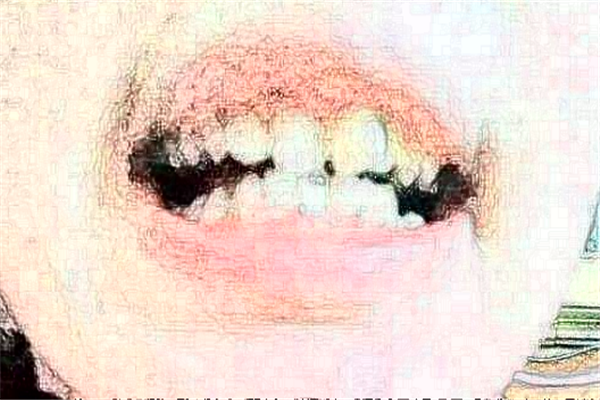 蘇州姑蘇美奧口腔是正規(guī)醫(yī)院嗎_地址_收費標(biāo)準(zhǔn)