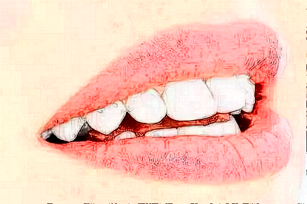 重慶維樂(lè)口腔醫(yī)院拔牙如何?拔牙要多久恢復(fù)