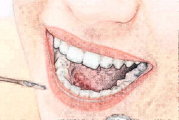 2024天津南開(kāi)醫(yī)院隱形矯正費(fèi)用多少_醫(yī)生名單