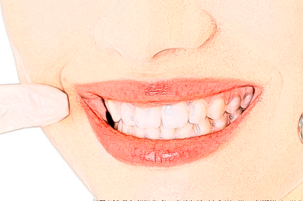 2024齊齊哈爾市中醫(yī)院瓷貼面費用多少_真實案例反饋