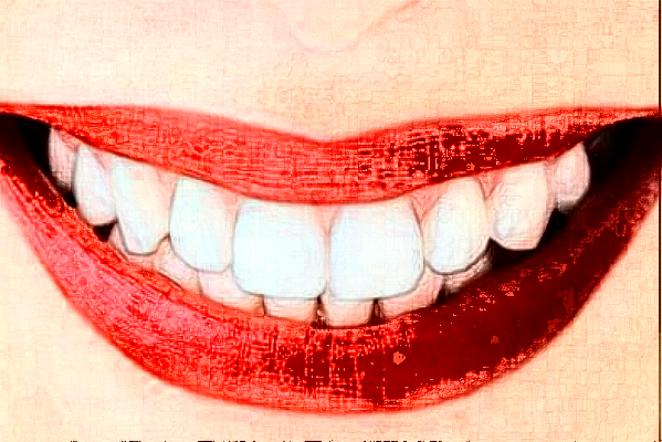 天津南開醫(yī)院牙列不齊矯正怎么樣_案例_價(jià)格