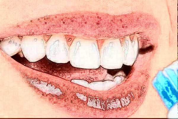 福州福能海峽口腔醫(yī)院舌側矯正怎么樣_醫(yī)生排名介紹