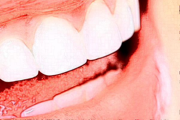 贛州貝殼口腔隱形矯正怎么樣，附醫(yī)生信息一覽~