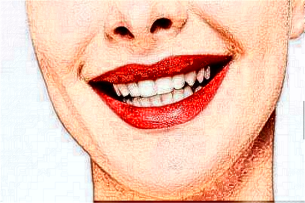 杭州植得口腔門診部烤瓷牙價格表(價目表)怎么樣