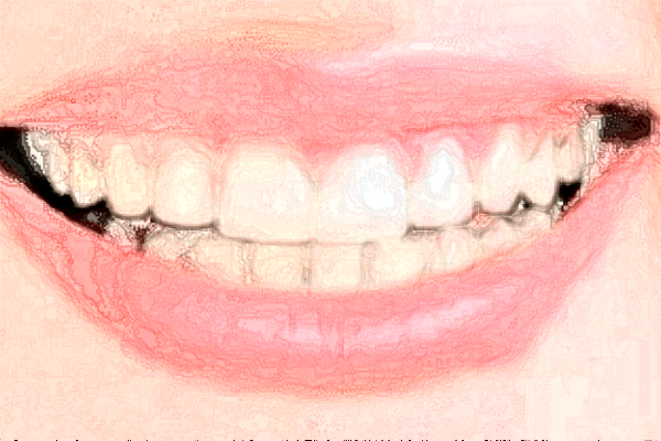 北京牙管家口腔診所隱適美怎么樣|醫(yī)生介紹|價格收費(fèi)