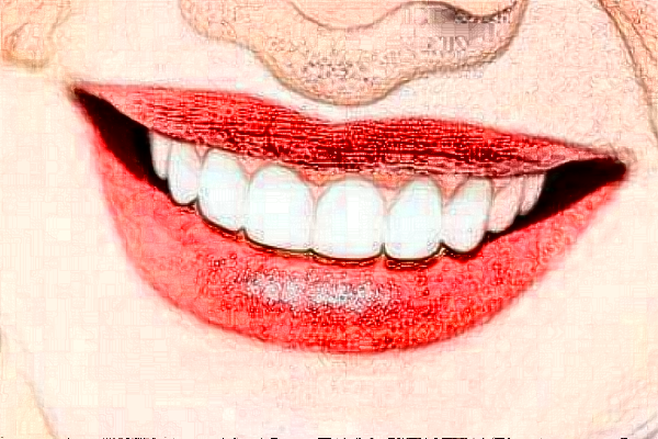 2024鄭州唯美口腔醫(yī)院微創(chuàng)種植怎么樣_微創(chuàng)種植牙要多長(zhǎng)時(shí)間