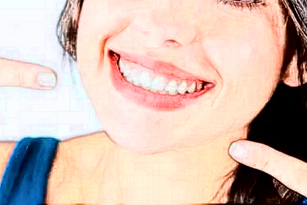 重慶團(tuán)圓口腔醫(yī)院拔牙哪個(gè)醫(yī)生好?拔牙傷口多久愈合