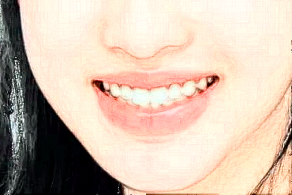 重慶世紀美奧口腔醫(yī)院醫(yī)生有哪些?附整牙案例