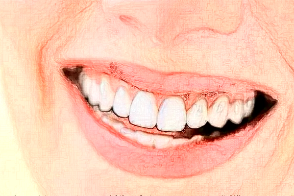 鄭州植得口腔醫(yī)院矯正怎么樣?2024矯正牙齒費用?