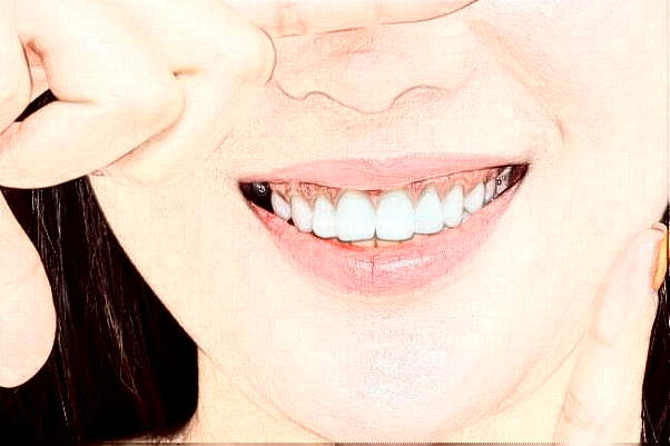 2024山東鉑爾口腔全瓷牙哪個(gè)醫(yī)生好?專(zhuān)家名單+案例反饋