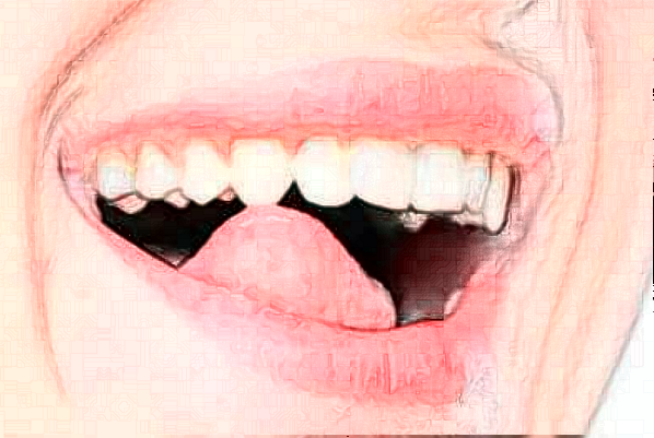 淮安諾貝爾口腔醫(yī)院全口種植怎么樣，附醫(yī)生信息一覽~