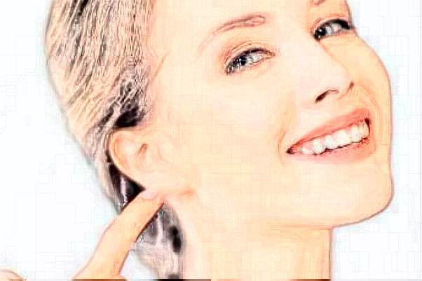 2024蘇州姑蘇美奧口腔合金烤瓷牙怎么樣_整形日記分享