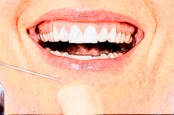 2024福州美橙口腔地包天矯正怎么樣，附醫(yī)生信息一覽~