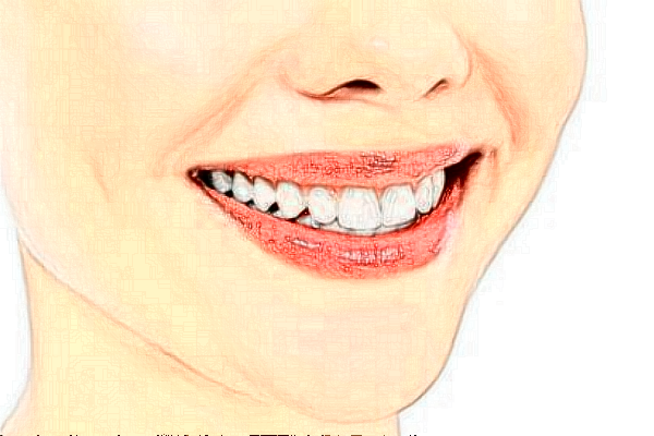 杭州植得口腔門診部瓷貼面價(jià)格表(價(jià)目表)怎么樣