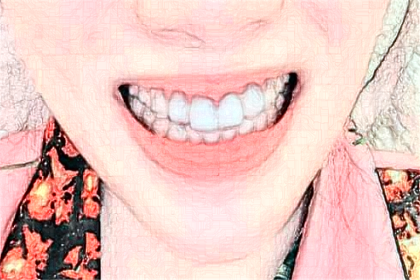 北京牙管家口腔診所超聲波洗牙怎么樣|醫(yī)生介紹|價格收費(fèi)