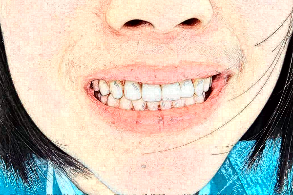 長沙好大夫口腔醫(yī)院半口牙種植好的大夫?醫(yī)生簡(jiǎn)介