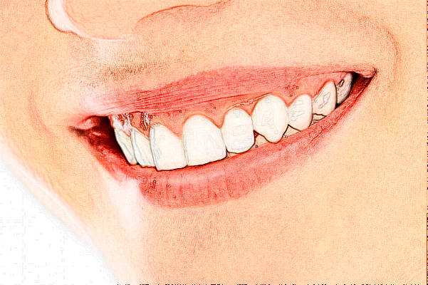 河南美奧口腔醫(yī)院醫(yī)生技術(shù)怎么樣?2024牙齒矯正收費(fèi)多少