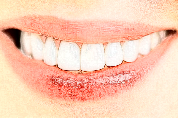 鄭州植得口腔醫(yī)院矯正牙齒靠譜嗎?2024矯正牙齒價格