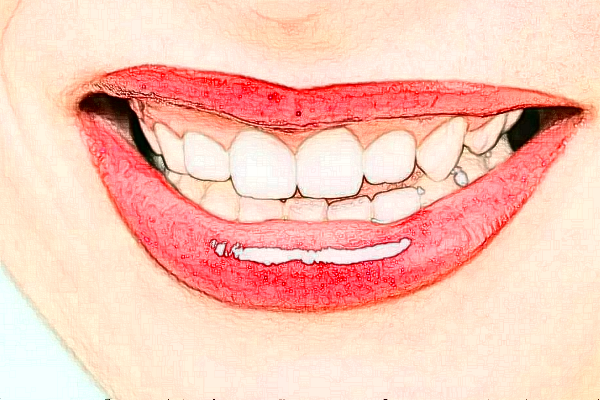 2024義烏傅氏口腔門診部噴砂洗牙價(jià)格?噴砂洗牙的危害