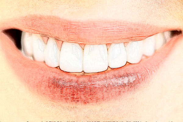 宣城大醫(yī)醫(yī)院種植牙的特點?種植牙的種植體系