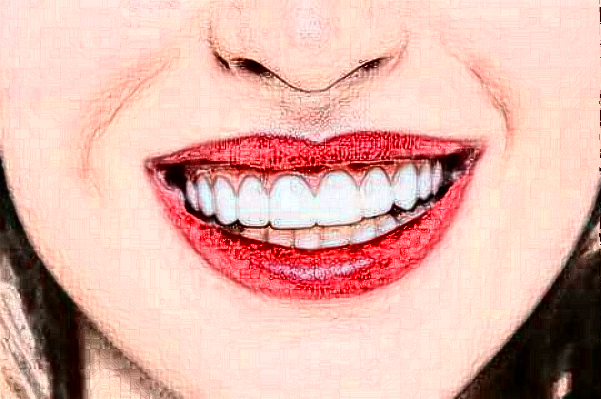 2024淮安諾貝爾口腔醫(yī)院瓷貼面哪個(gè)醫(yī)生好?專家名單+案例反饋