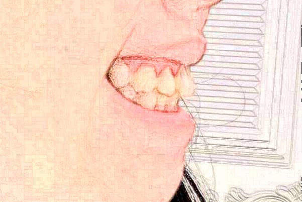 深圳樂(lè)莎莎口腔醫(yī)院醫(yī)生怎么樣?2024牙齒矯正怎么收費(fèi)