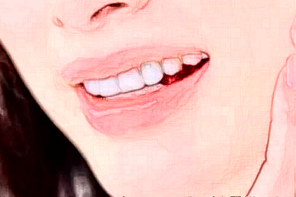 鄭州植得口腔醫(yī)院種植牙哪種材質(zhì)好?2024種植牙價格