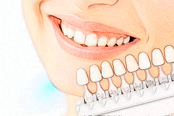 2024深圳樂莎莎口腔醫(yī)院隱形矯正價格?隱形矯正的優(yōu)點(diǎn)