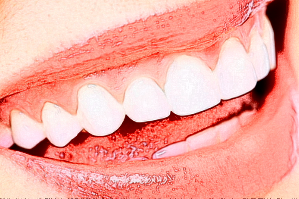 2024深圳樂莎莎口腔醫(yī)院隱形矯正價格?隱形矯正的優(yōu)點(diǎn)