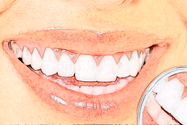 深圳樂(lè)莎莎口腔醫(yī)院有哪些醫(yī)生?矯正牙齒的醫(yī)生案例