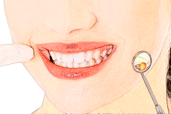 宣城大醫(yī)醫(yī)院瓷貼面有哪幾種?瓷貼面牙齒有危害嗎