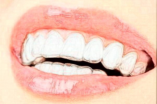 長沙科爾雅口腔醫(yī)院冷光美白做的好嗎?哪位醫(yī)生做得好